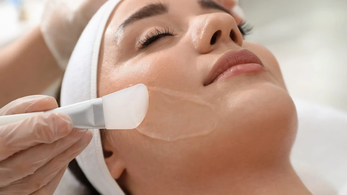 Chemical Peels in Las Vegas